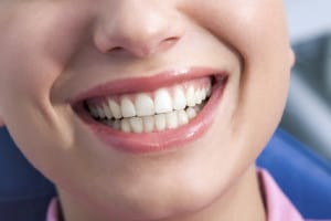 Close-up of happy female showing her healthy teeth in smile Note to inspector: the image is pre-Sept 1 2009