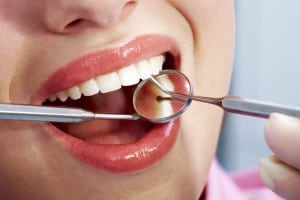 Image of teeth being checked by doctor